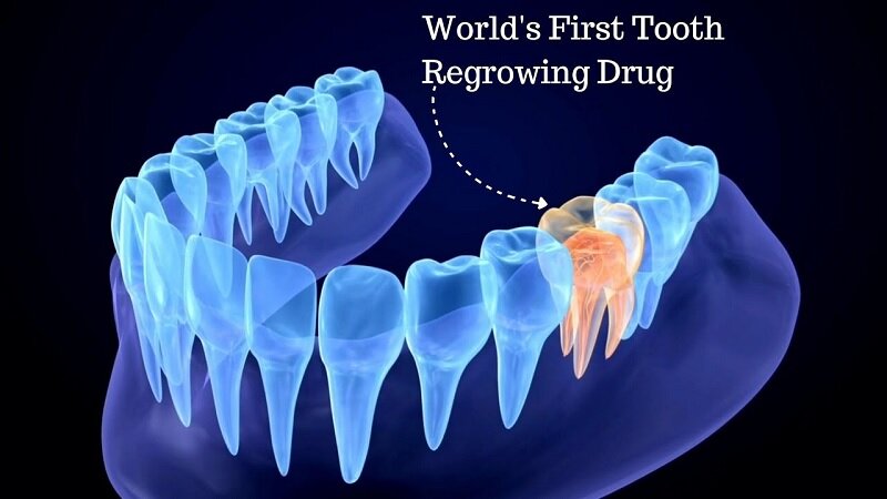 رشد دوباره دندان‌های انسان؛ امیدی تازه تا چهار سال آینده